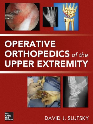 cover image of Operative Orthopedics of the Upper Extremity